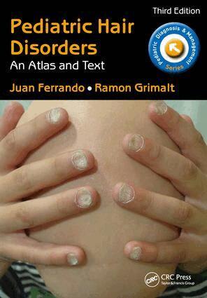 Juan Ferrando, Ramon Grimalt - Pediatric Hair Disorders, Häftad