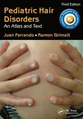 Pediatric Hair Disorders 1