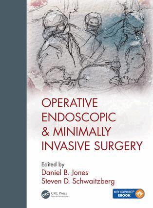 Daniel B. Jones, Steven Schwaitzberg, M.D. - Operative Endoscopic and Minimally Invasive Surgery, Inbunden