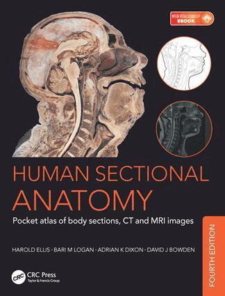 Bari M. Logan, Harold Ellis, Adrian Kendal Dixon, David J. Bowden - Human Sectional Anatomy, Häftad