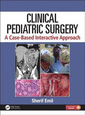 bokomslag Clinical Pediatric Surgery