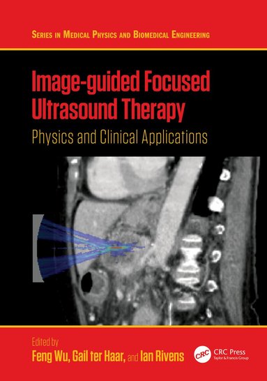 Feng Wu, Gail ter Haar, Ian Rivens - Image-guided Focused Ultrasound Therapy, Inbunden