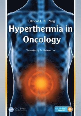 Hyperthermia in Oncology 1