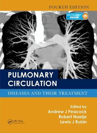 Andrew J. Peacock, Robert Naeije, Lewis J. Rubin - Pulmonary Circulation, Inbunden