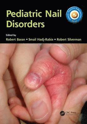 bokomslag Pediatric Nail Disorders