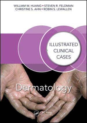 William W. Huang, Steven R. Feldman, Christine S. Ahn, Robin S. Lewallen - Dermatology, Häftad