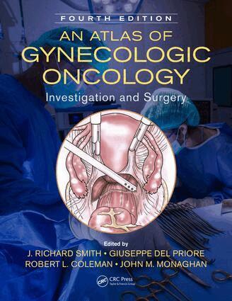 J. Richard Smith, Giuseppe Del Priore, Robert L. Coleman, John M. Monaghan - Atlas of Gynecologic Oncology, Inbunden