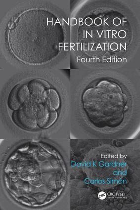 David K. Gardner, Carlos Simón - Handbook of In Vitro Fertilization, Häftad