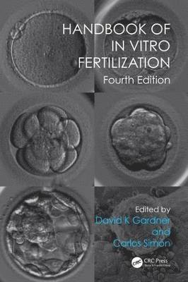 Handbook of In Vitro Fertilization 1