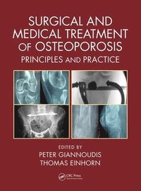 bokomslag Surgical and Medical Treatment of Osteoporosis