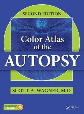 Color Atlas of the Autopsy 1