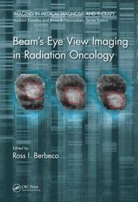 bokomslag Beam's Eye View Imaging in Radiation Oncology