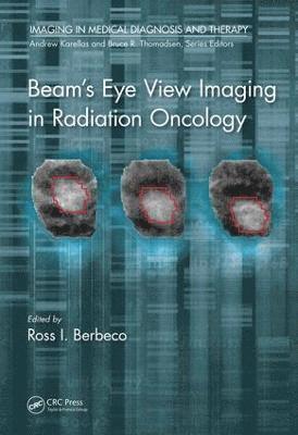 bokomslag Beam's Eye View Imaging in Radiation Oncology