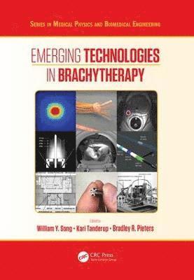 William Y. Song, Kari Tanderup, Bradley Pieters, Canada) Song, William Y. (Odette Cancer Centre, Sunnybrook Health Science Centre, Toronto, Aarhus University) Tanderup, Kari (Aarhus University Hospital - Emerging Technologies in Brachytherapy, Inbunden