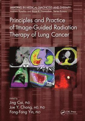 bokomslag Principles and Practice of Image-Guided Radiation Therapy of Lung Cancer