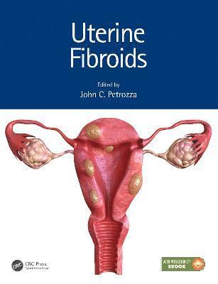 bokomslag Uterine Fibroids