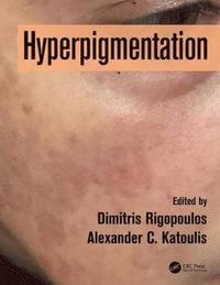 bokomslag Hyperpigmentation