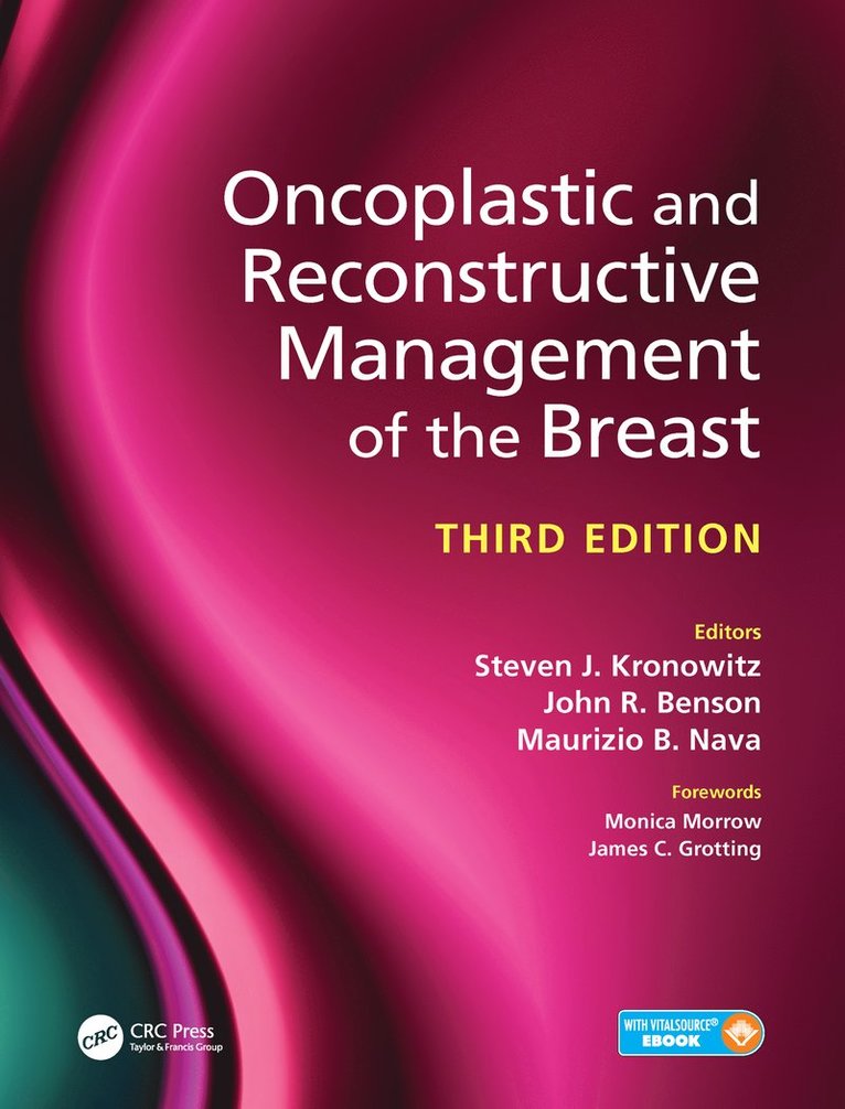 Steven Kronowitz, John Benson, Maurizio Nava, UK) Benson, John (Addenbrooke's Hospital, Cambridge, Italy) Nava, Maurizio (Instituto Nazionale Tumori, Milan - Oncoplastic and Reconstructive Management of the Breast, Third Edition, Inbunden