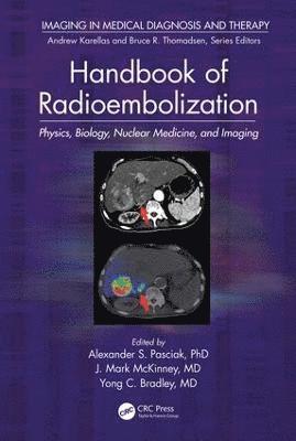 Handbook of Radioembolization 1