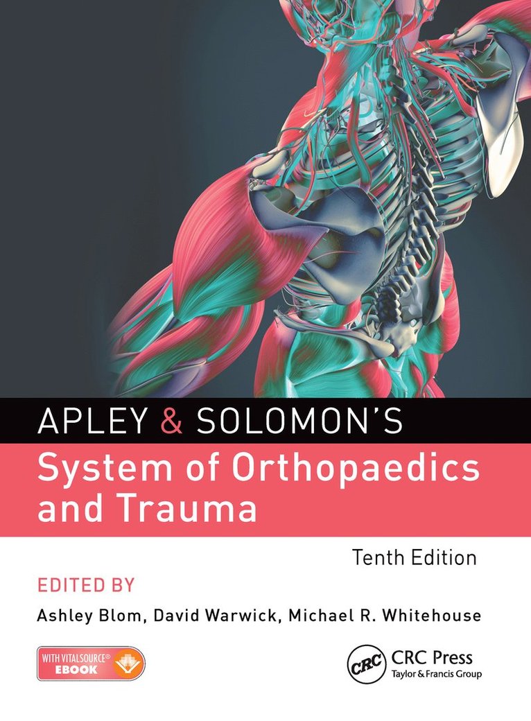 Ashley Blom, David Warwick, Michael Whitehouse, United Kingdom) Blom, Ashley (University of Bristol, United Kingdom) Warwick, David (University Hospital, Southampton, United Kingdom) Whitehouse, Michael (University of Bristol - Apley & Solomon's System of Orthopaedics and Trauma, Inbunden