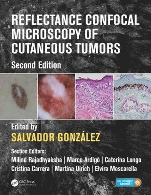 Salvador Gonzalez, USA) Gonzalez, Salvador (Department of Medicine and Medical Specialties, Alcala University, Madrid, Spain and Dermatology Unit, Memorial Sloan Kettering Cancer Center, New York, NY - Reflectance Confocal Microscopy of Cutaneous Tumors, Inbunden
