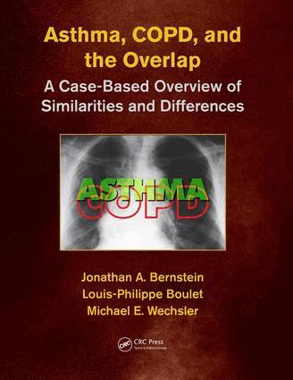 Jonathan A. Bernstein, Louis-Philippe Boulet, Michael E. Wechsler, MD,MMSc - Asthma, COPD, and Overlap, Häftad