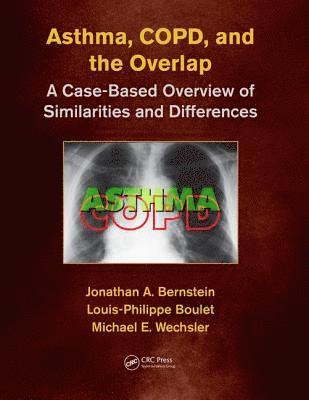 bokomslag Asthma, COPD, and Overlap