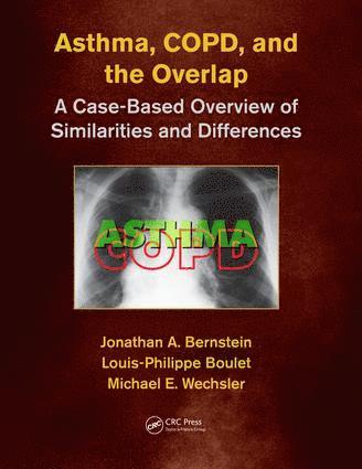 Jonathan A. Bernstein, Louis-Philippe Boulet, Michael E. Wechsler, MD,MMSc, USA) Bernstein, Jonathan A. (University of Cincinnati, Cincinnati, Ohio, USA) Wechsler, MD,MMSc, Michael E. (National Jewish Health, Denver, Colorado - Asthma, COPD, and Overlap, Häftad