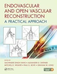 bokomslag Endovascular and Open Vascular Reconstruction