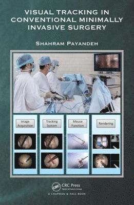 Visual Tracking in Conventional Minimally Invasive Surgery 1