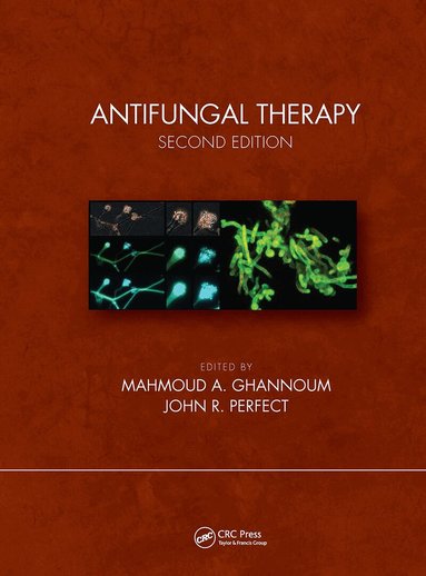 Mahmoud A. Ghannoum, John R. Perfect - Antifungal Therapy, Second Edition, Inbunden
