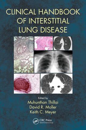 Keith C. Meyer, Muhunthan Thillai, David R. Moller, Steven D. Nathan - Clinical Handbook of Interstitial Lung Disease, Häftad