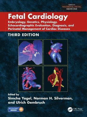 bokomslag Fetal Cardiology