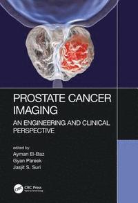 bokomslag Prostate Cancer Imaging