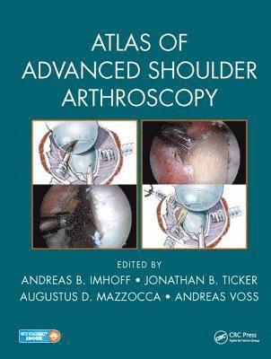Atlas of Advanced Shoulder Arthroscopy 1
