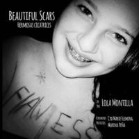 bokomslag Beautiful Scars Hermosas Cicatrices