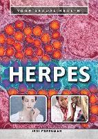 bokomslag Herpes