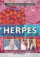Herpes