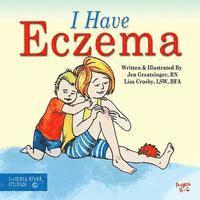 bokomslag I Have Eczema