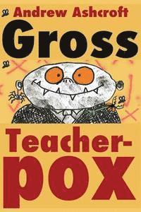 Gross Teacherpox b/w: Budget Version 1
