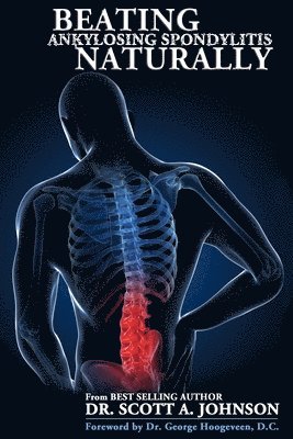 bokomslag Beating Ankylosing Spondylitis Naturally