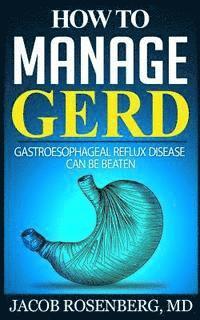 How to manage GERD: Gastroesophageal reflux disease can be beaten 1