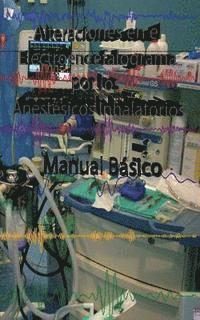 Eugenio Martinez Hurtado - Alteraciones en el Electroencefalograma por los Anestesicos Inhalatorios: Manual basico, Häftad