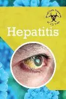 Petra Miller - Hepatitis, Inbunden. Tillgänglighet: Lägg i varukorg