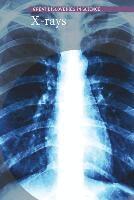 Kristin Thiel - X-Rays, Inbunden