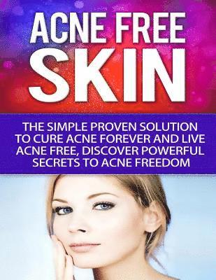 bokomslag Acne-Free Skin: Simple Proven Solution To Cure Acne Forever and Live Acne-Free, Discover Powerful Secrets to Acne Freedom