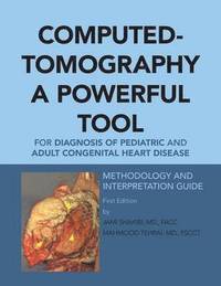 bokomslag Computed-Tomography a Powerful Tool for Diagnosis of Pediatric and Adult Congenital Heart Disease