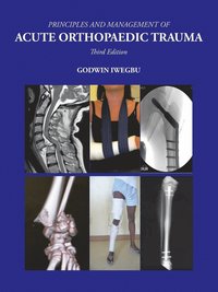 bokomslag Principles and Management of Acute Orthopaedic Trauma