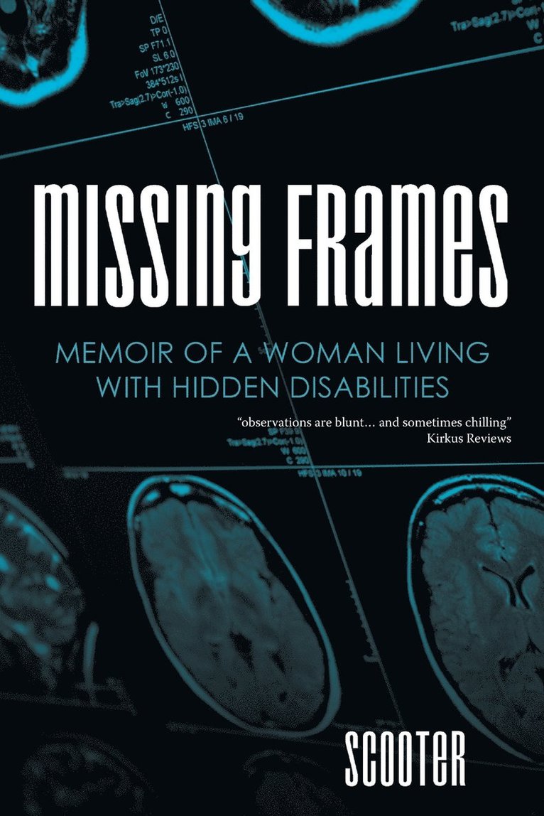 Missing Frames 1