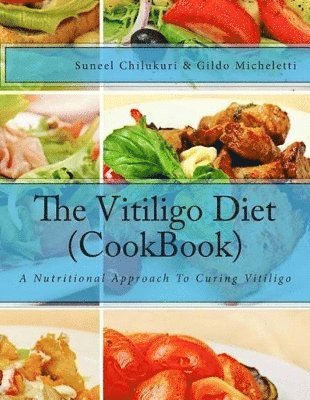 The Vitiligo Diet (CookBook) 1